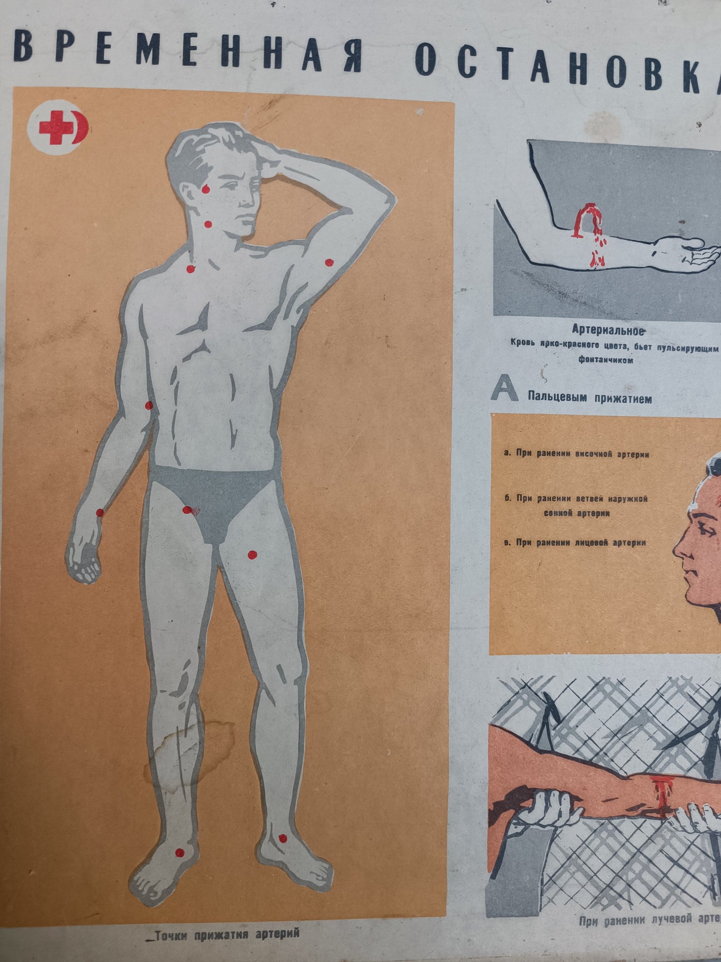 Double Sided Medical Poster. "How to Stop Temporary Bleeding"