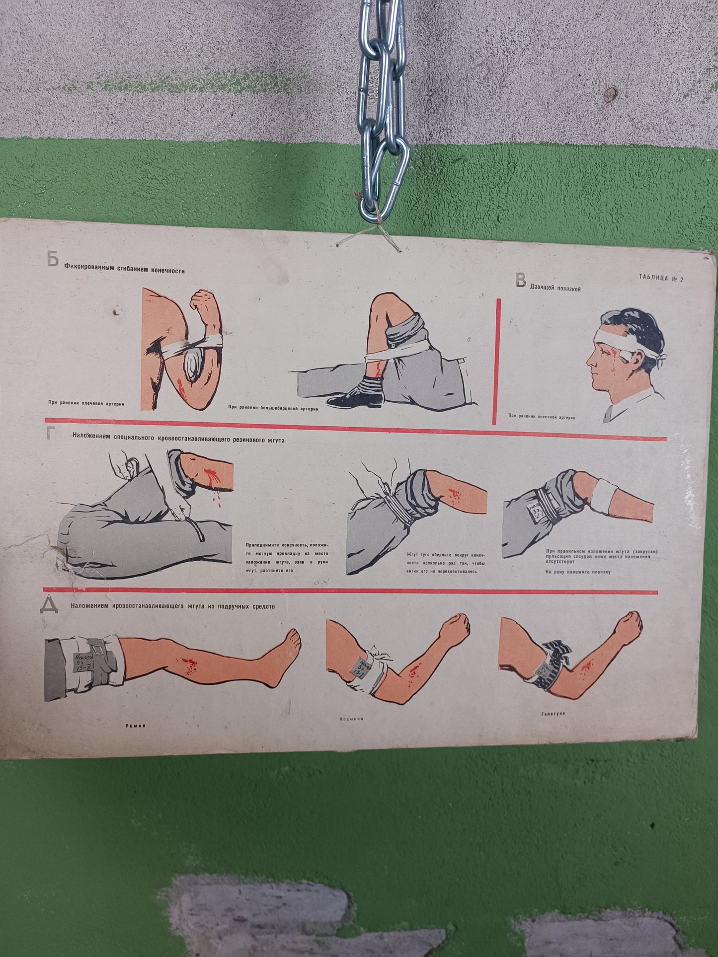 Double Sided Medical Poster. "How to Stop Temporary Bleeding"